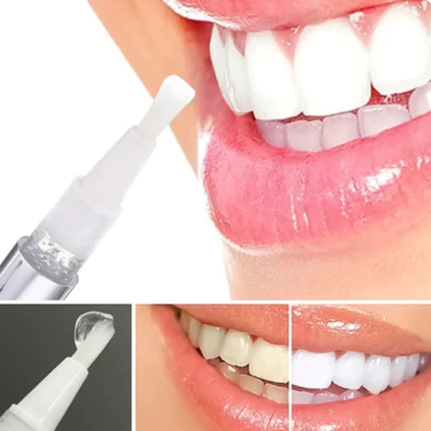 Gel Blanqueador Dental Dazzling White®